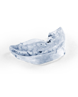 SnorBan ferula de avance mandibular